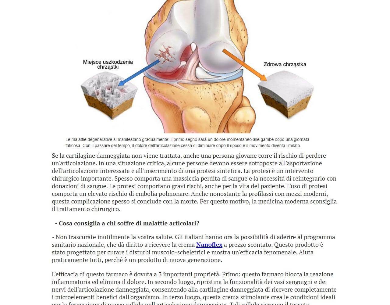 Nanoflex 3